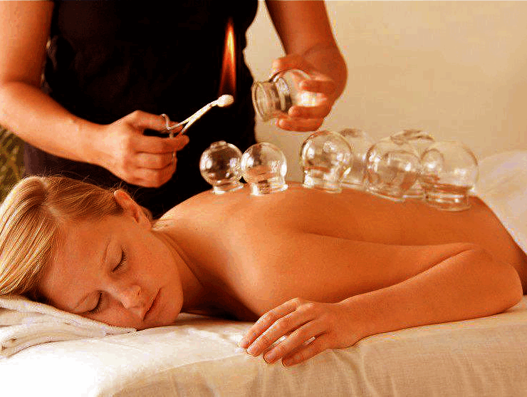 Cupping therapy treatment
